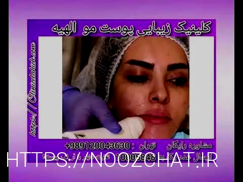 آر اف بهتر است یا هایفو