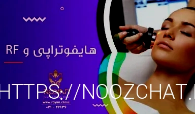 آر اف بهتر است یا هایفو